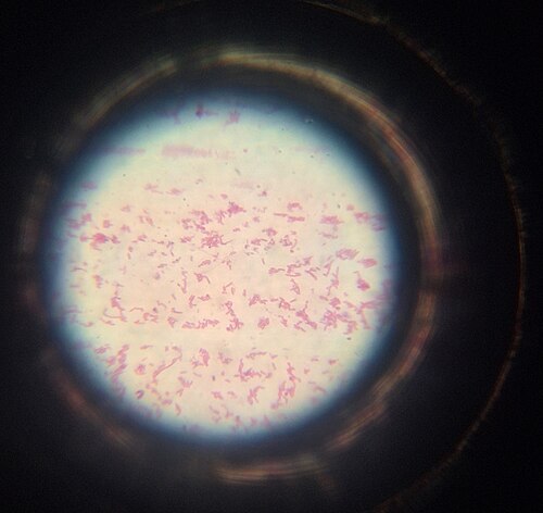 Microscopisch beeld van bacteriën